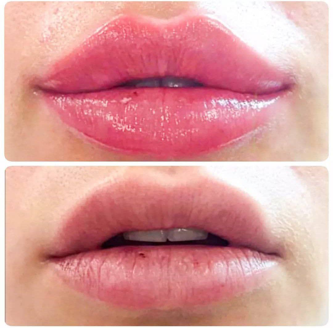 کلینیک زیبایی و لاغری لوتوس دکتر حصاری در بجنورد